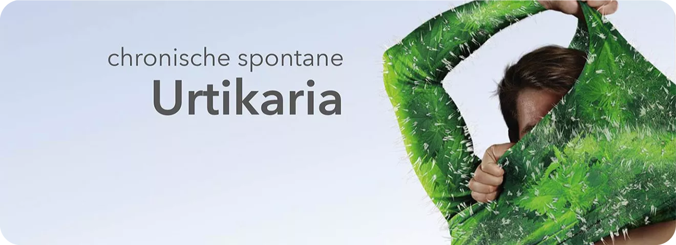 chronische spontane Urtikaria