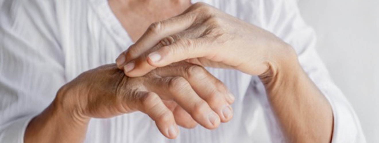 Eine Frau reibt sich mit der einen, ihre andere scheinbar schmerzende Hand.