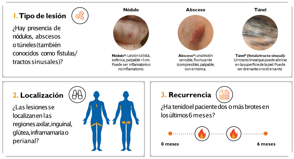 claves