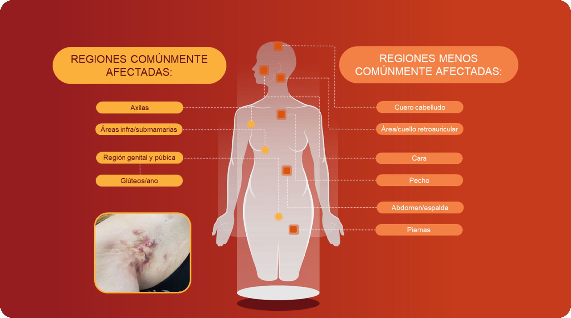 lesiones