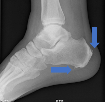case001_03_rev.png case001_03_rev.png