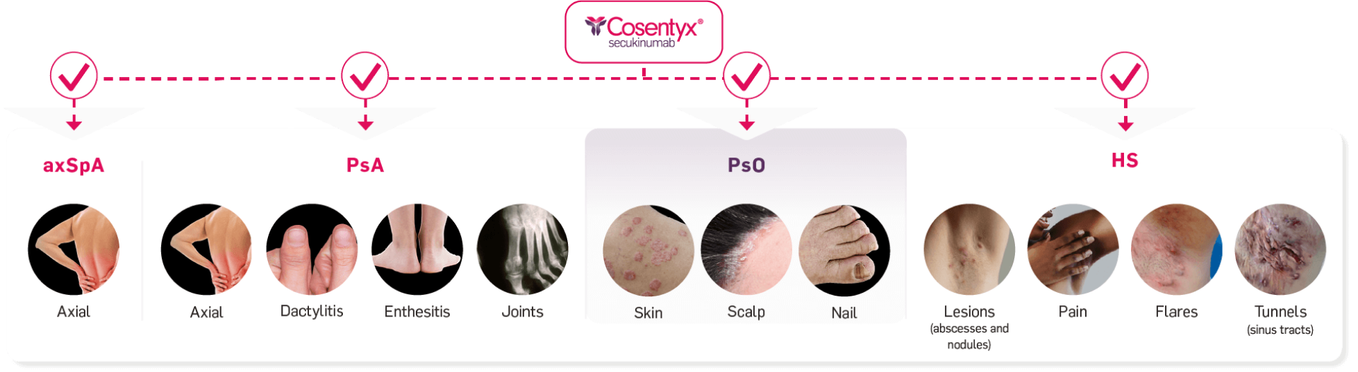 Graphic highlighting that Cosentyx works across the key manifestations of axSpA, PsA, PsO and HS.